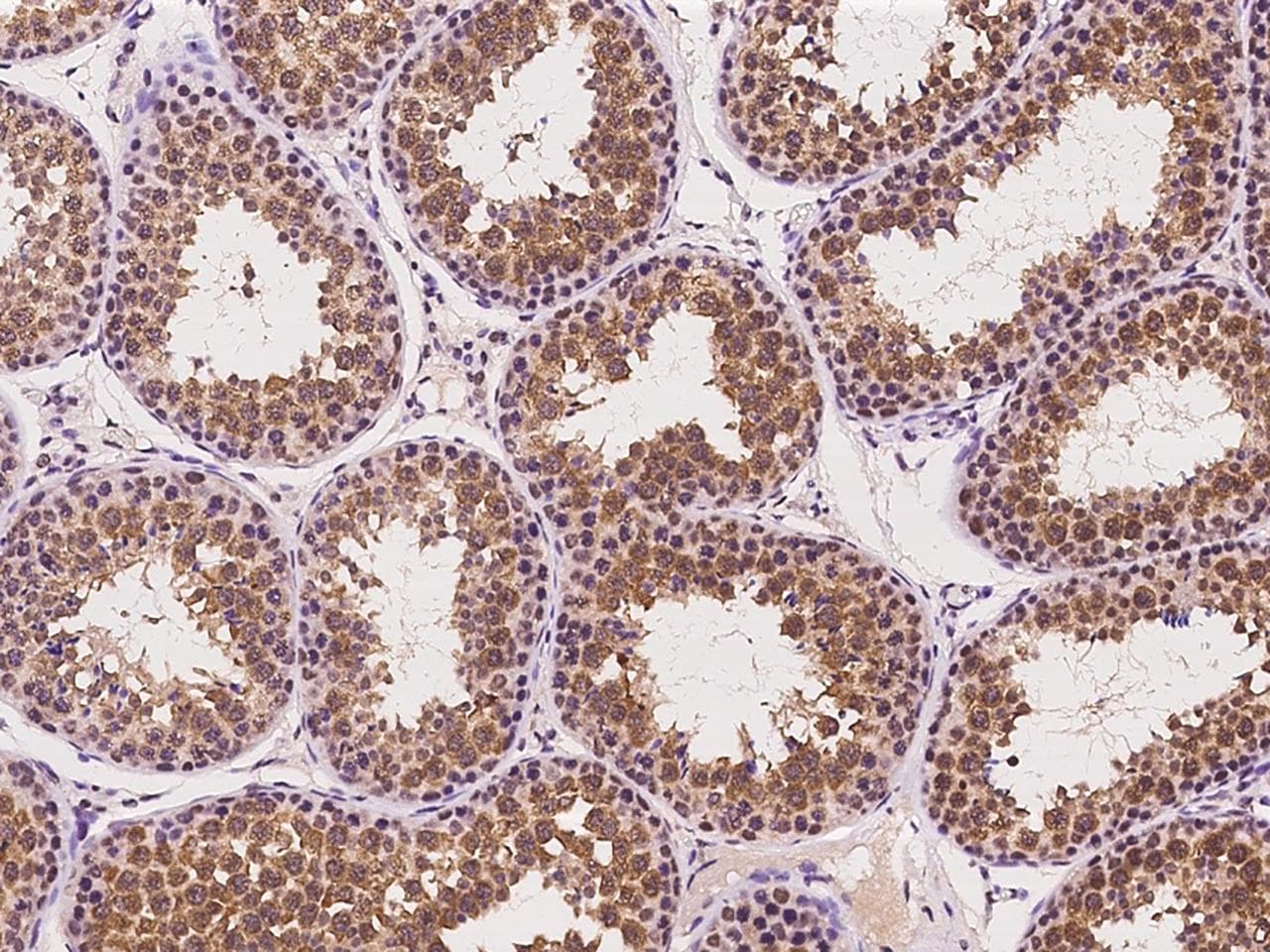 IFT81 Antibody