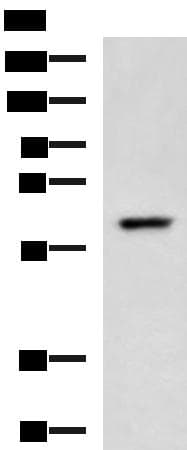 TRF1 / TERF1 Antibody