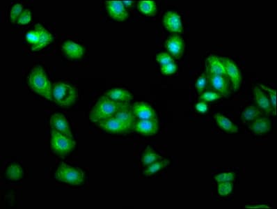 Polyclonal Rabbit anti-Human AGXT2 Antibody (IF, WB)