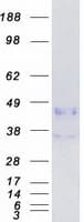 Human CTSB / Cathepsin B Protein (Recombinant Myc-DDK (Flag))