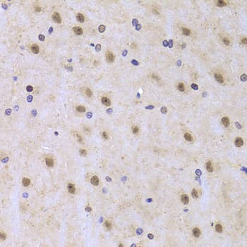 Polyclonal Rabbit anti-Human NF45 / ILF2 Antibody (IHC, IF, WB)