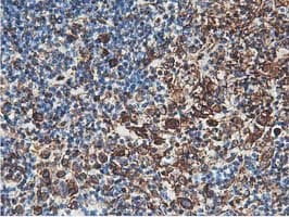 Latexin / MUM Antibody (clone OTI1E10)