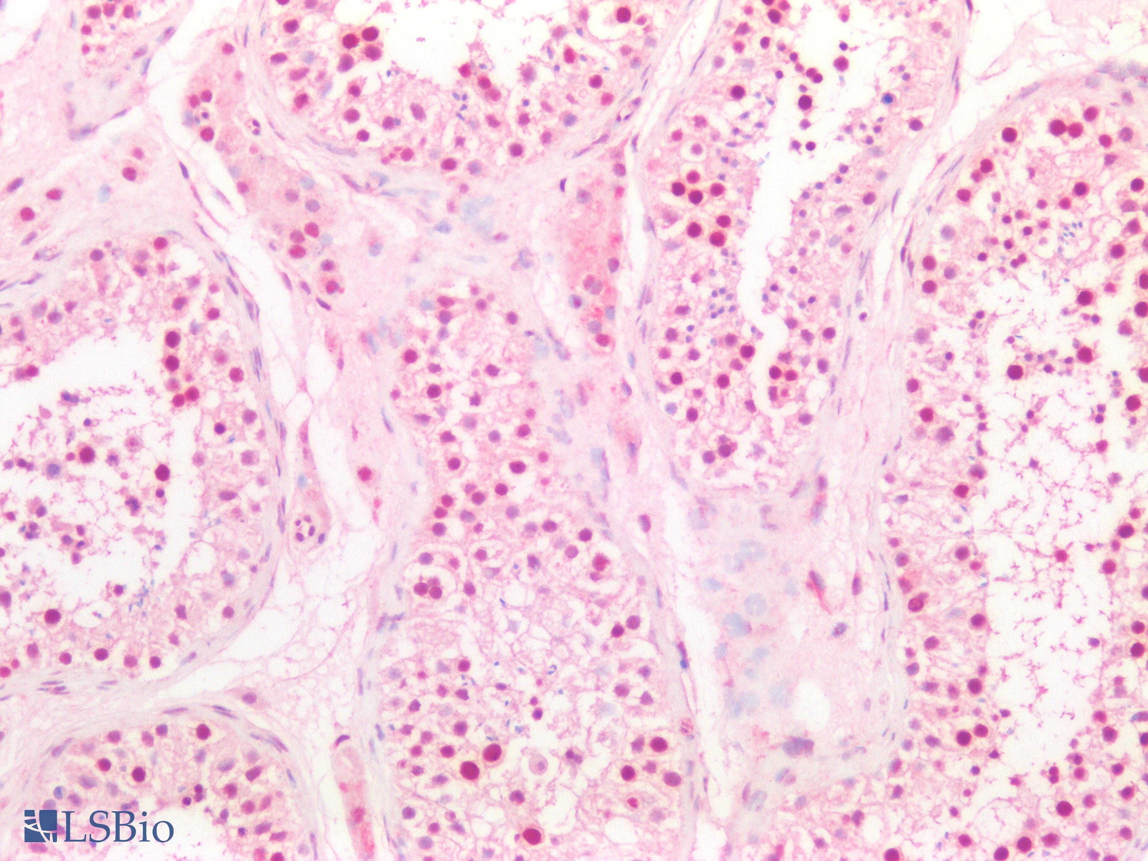 PathPlus™ Polyclonal Goat anti-Human MSH6 Antibody (aa350-400, IHC)