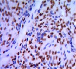 Monoclonal Mouse anti-Human GATA1 Antibody (clone 4F5, IHC, IF, WB)