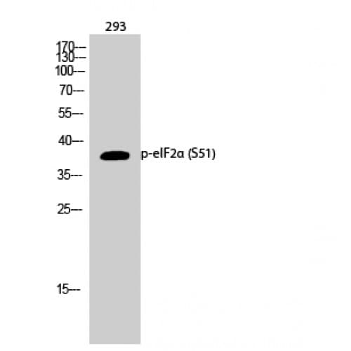 Polyclonal Rabbit anti-Human EIF2S1 Antibody (pS51, IHC, WB)