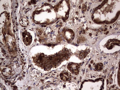 DOCK8 Antibody (aa832-1160, clone OTI4H10)