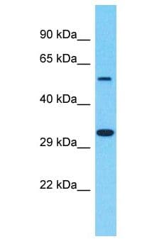 OR8B4 Antibody (aa257-306)