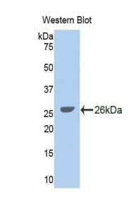 GLDC Antibody (aa627-833, PE)
