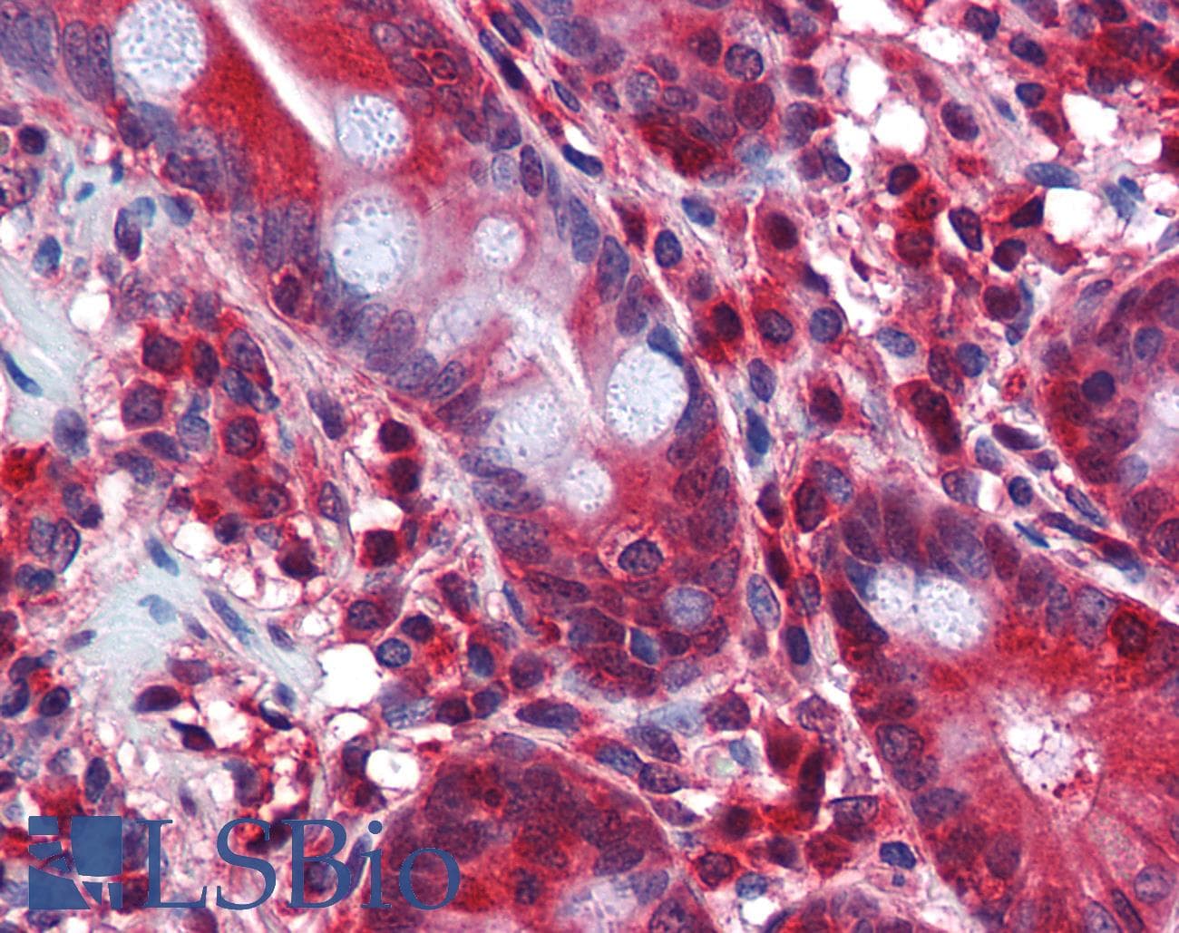 IHC-plus™ Monoclonal Mouse anti-Human STI1 / STIP1 Antibody (clone 1E3, IHC, IF, WB)