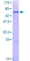 Human AGER / RAGE Protein (Recombinant GST)