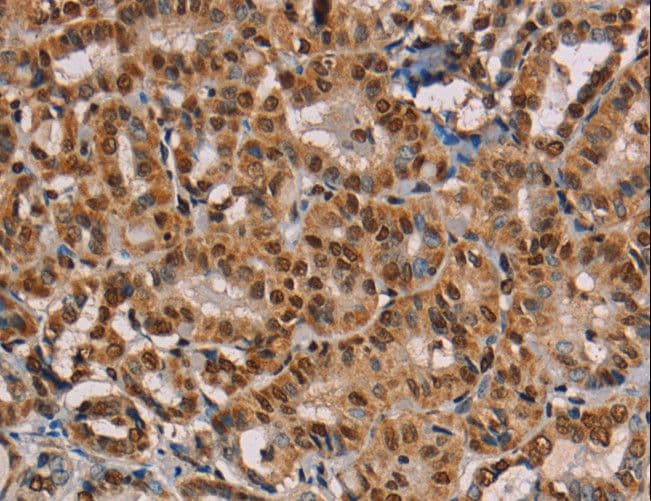 RBMX Antibody