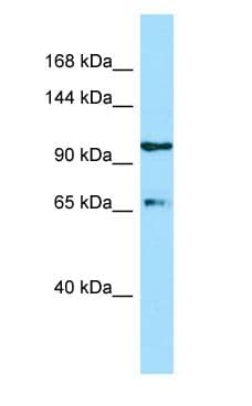 Polyclonal Rabbit anti-Human ESF1 Antibody (C-Terminus, WB)