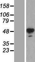 Human TH / Tyrosine Hydroxylase Protein (Over-Expression Lysate Myc-DDK (Flag))