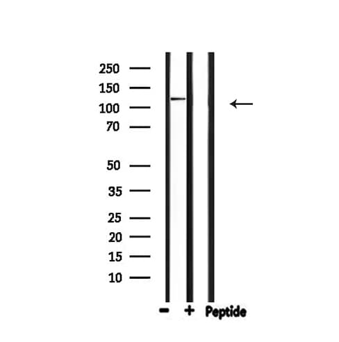 Polyclonal Rabbit anti-Human NOS2 / iNOS Antibody (IHC, IF, WB)