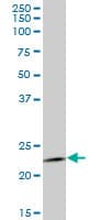 RAB1B Antibody (clone 1B2)