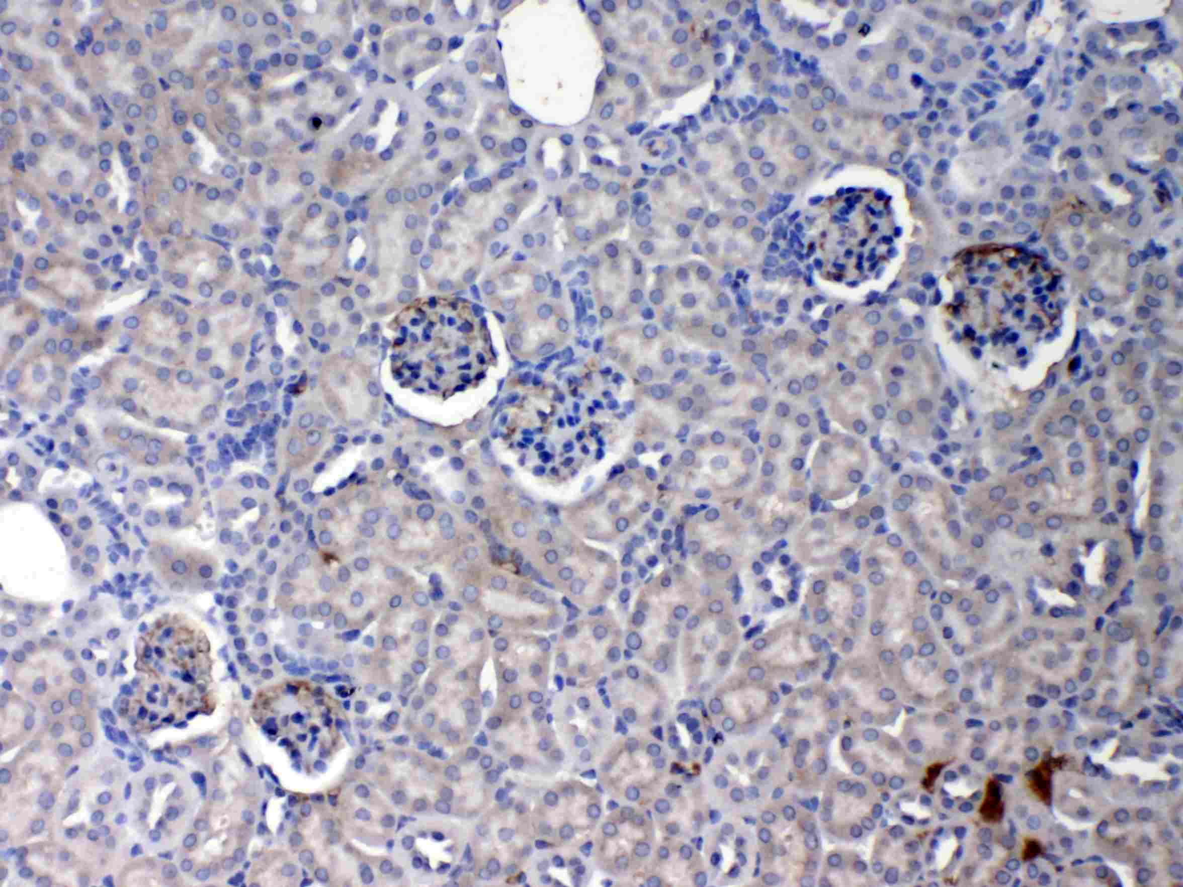 CRP / C-Reactive Protein Antibody