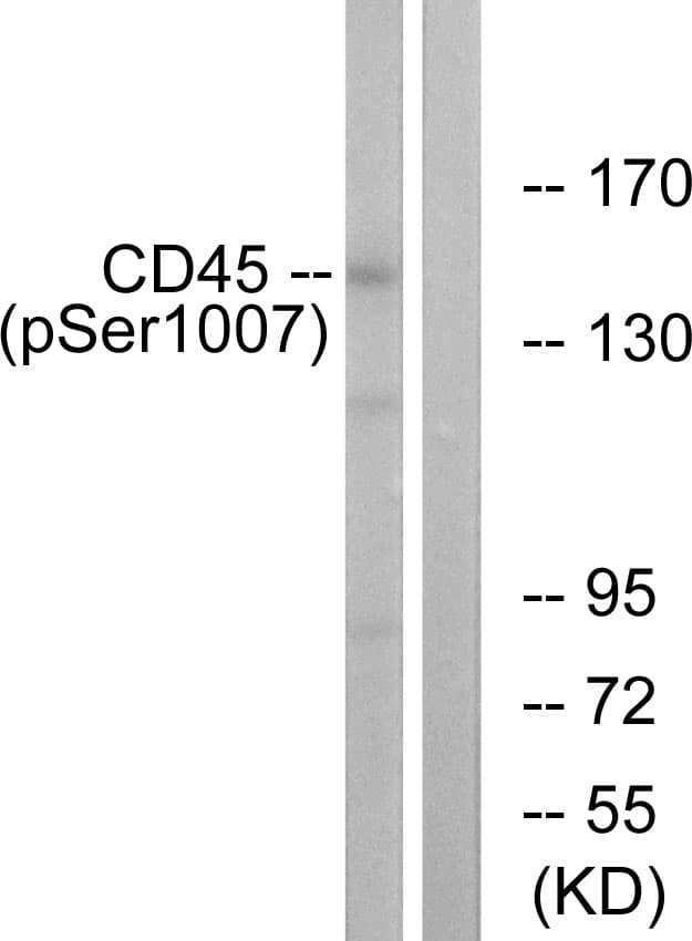 CD45 / LCA Antibody (phospho-Ser1007)