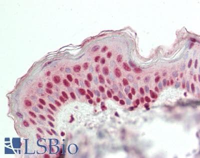 GRHL1 / TFCP2L2 Antibody (C-Terminus)
