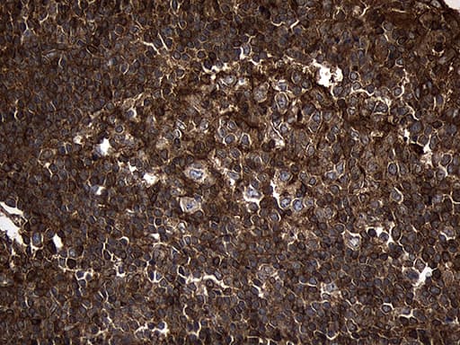 MLC3F / MYL1 Antibody (aa2-150, clone OTI1D9)