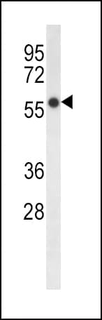 Delta-6 Desaturase / FADS2 Antibody (aa79-108)