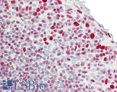 IHC-plus™ Polyclonal Rabbit anti-Human PML Antibody (IHC, IF, WB)