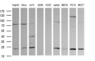RAB30 Antibody (clone OTI3B7)