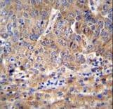 Polyclonal Rabbit anti-Human C1orf107 / DEF Antibody (aa2-30, IHC, IF, WB)