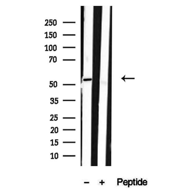 SPTLC2 / LCB2 Antibody