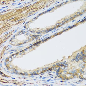 Polyclonal Rabbit anti-Human Placental Lactogen Antibody (IHC, WB)