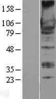 ARHGEF2 / GEF-H1 Protein (Over-Expression Lysate Myc-DDK (Flag))
