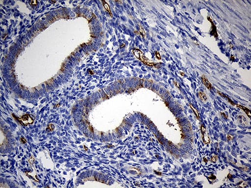 TSPAN7 / CD231 Antibody (clone OTI2D6, Carrier-free)