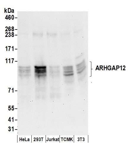 Polyclonal Rabbit anti-Human ARHGAP12 Antibody (aa100-150, WB)