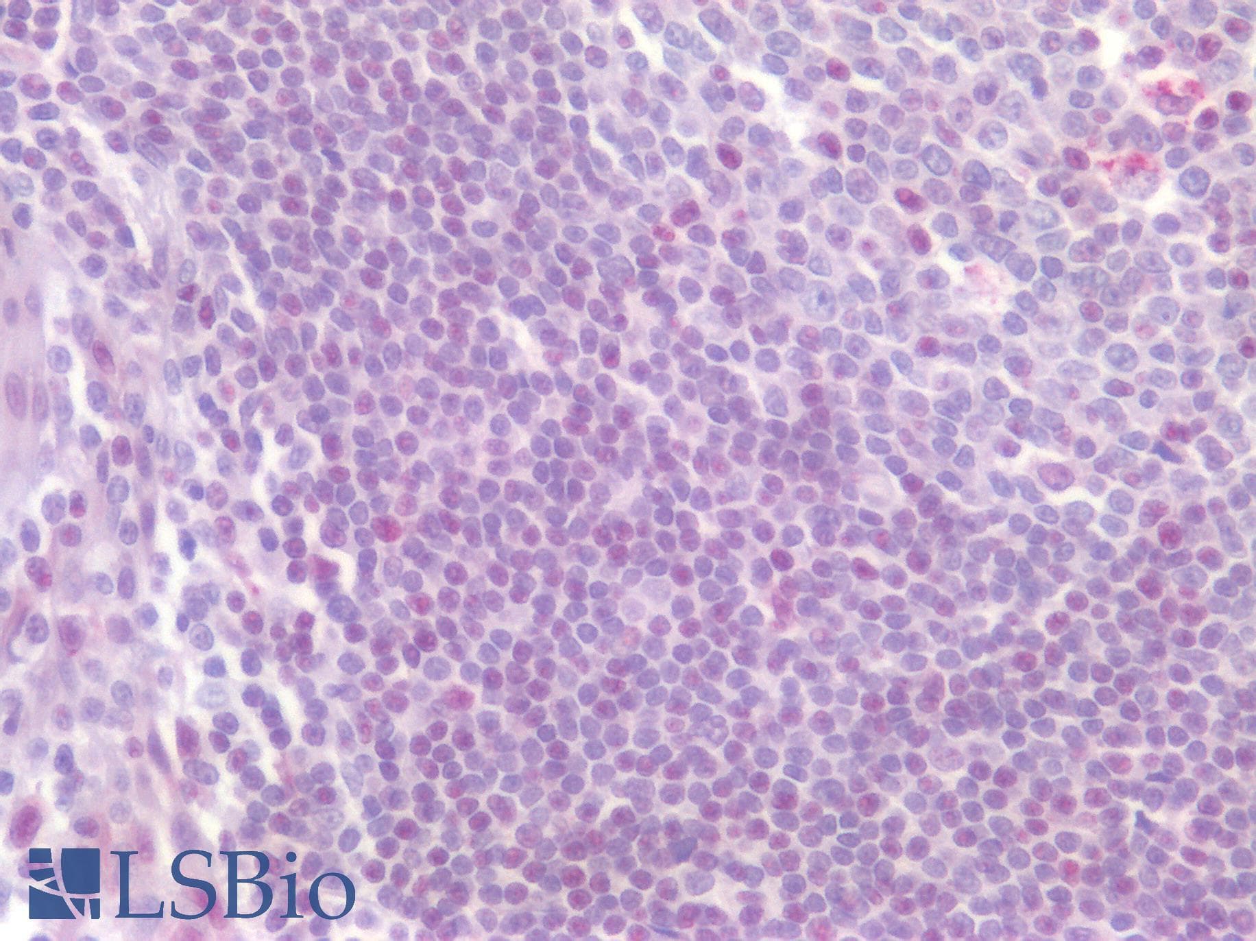 IHC-plus™ CD4 Antibody (Extracellular Domain)