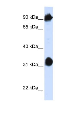 Polyclonal Rabbit anti-Human HSPA4 / APG-2 Antibody (aa36-85, WB)
