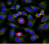 BCL2L1 / BCL-XL Antibody