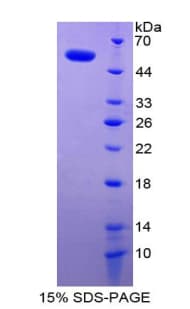 Human SDC1 / Syndecan 1 / CD138 Protein (Recombinant His-GST)