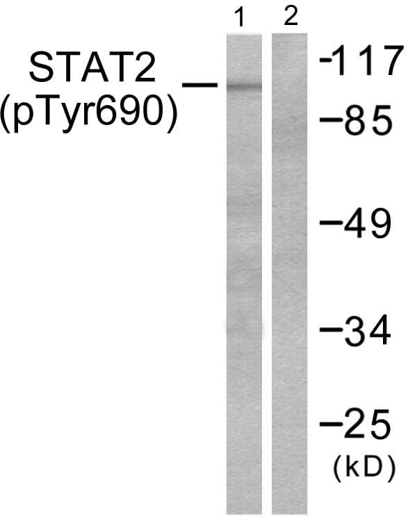 Polyclonal Rabbit anti-Human STAT2 Antibody (phospho-Tyr690, IHC, WB)