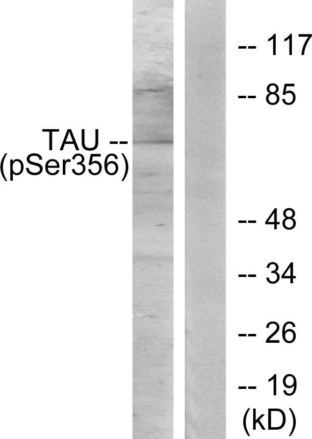 Polyclonal Rabbit anti-Human MAPT / Tau Antibody (phospho-Ser356, IHC, WB)