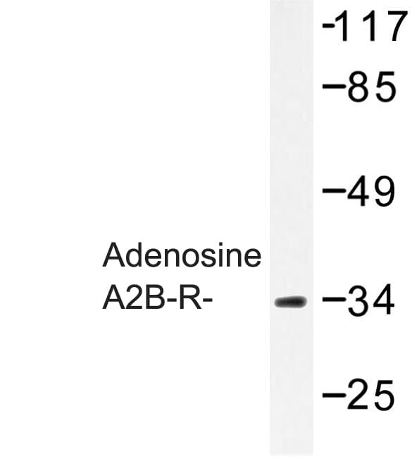 Polyclonal Rabbit anti-Human ADORA2B/Adenosine A2B Receptor Antibody (Trp270, IF, WB)