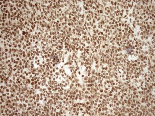 EXOSC1 / CSL4 Antibody (clone OTI1H9)
