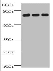 Polyclonal Rabbit anti-Human CXXC1 / CGBP Antibody (aa1-210, IHC, WB)