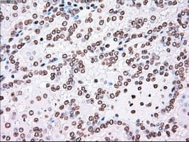 PLK1 / PLK-1 Antibody (clone OTI1D4)