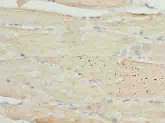IHC-plus™ PPP1R3B Antibody