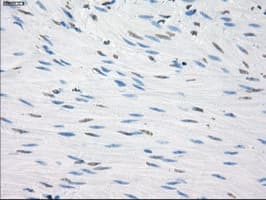 CD32A Antibody (clone OTI20D1)