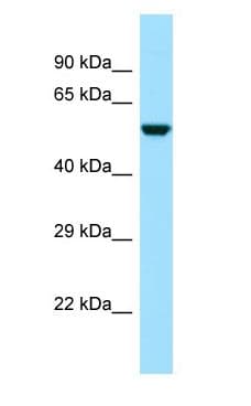 CDK5RAP3 Antibody (aa117-166)