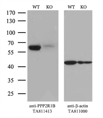 Monoclonal Mouse anti-Human PPP2R1B Antibody (clone OTI8B6, Carrier-free, aa19-601, IHC, WB)