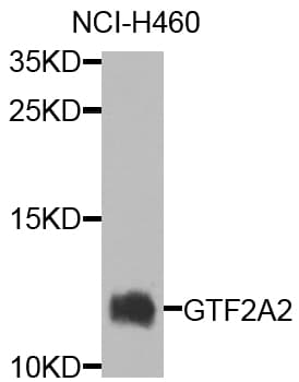 GTF2A2 / TFIIA Antibody