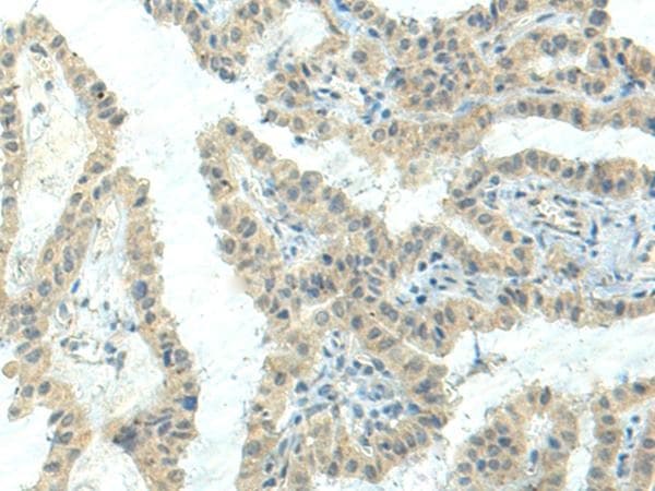 NPVF Antibody