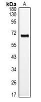 RORA / ROR Alpha Antibody