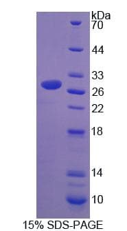 Mouse UPB1 Protein (Recombinant His-T7)